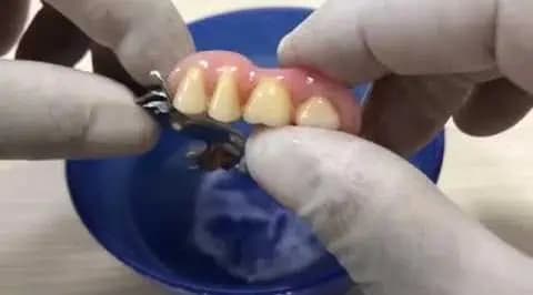 Zubný technik ukázal, ako správne čistiť zubnú protézu: Zabudnite na zastaralé spôsoby a vyskúšajte to urobiť takto!