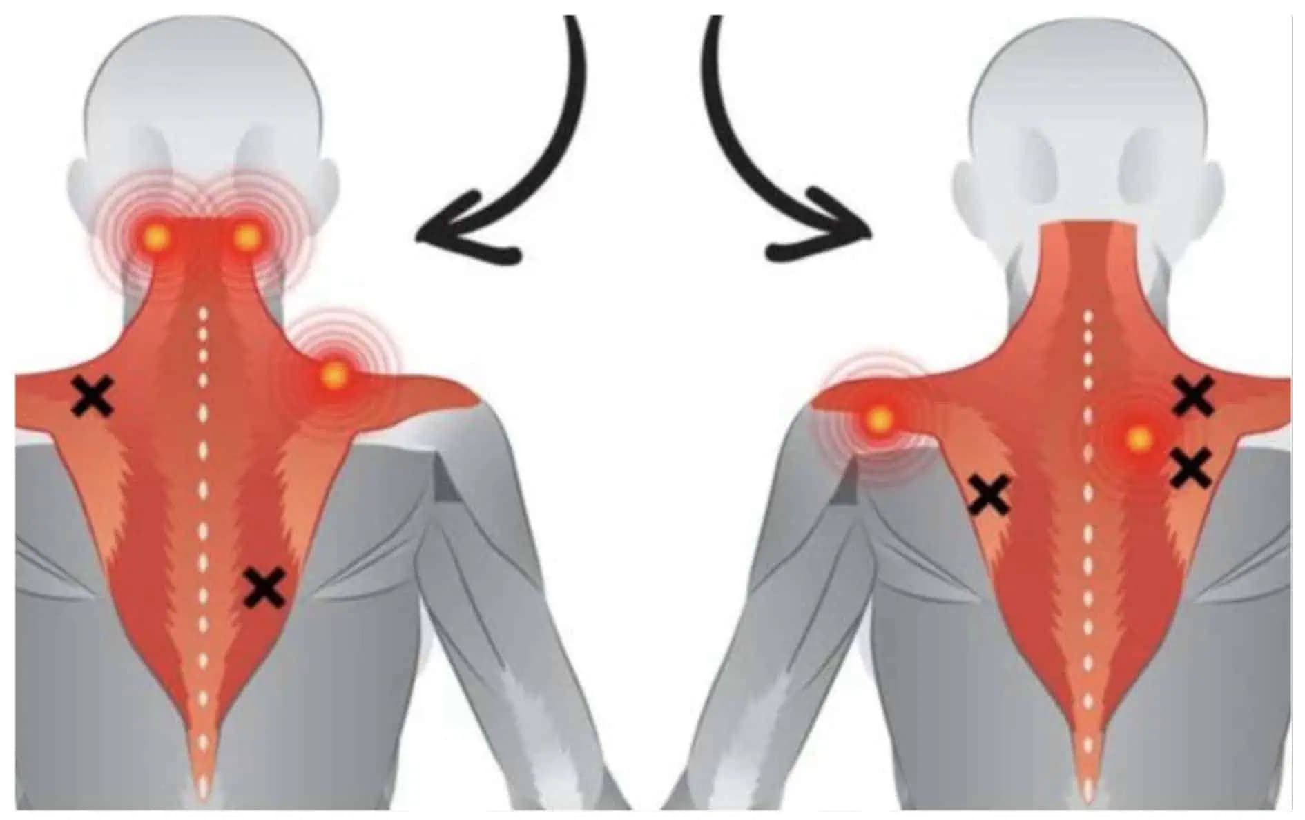Nemecký ŠPECIALISTA na bolesť ukázal  jednoduchý cvik, ktorý dokáže uvoľniť napätie v krčnej chrbtici: Naučte sa ho!