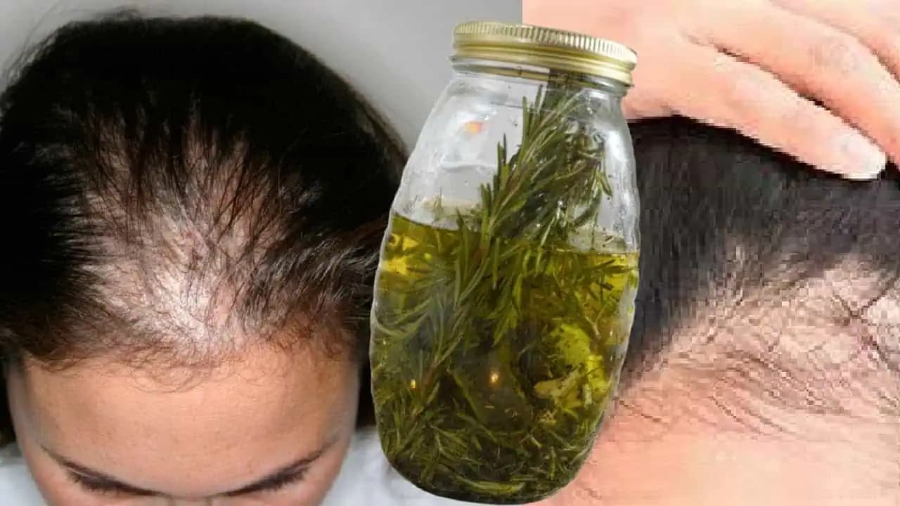 Zázračná kúra proti vypadávaniu vlasov: Viditeľné výsledky už za 3 dni!