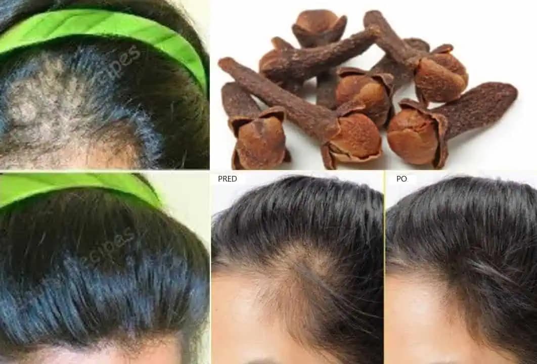 Indické tajomstvo krásnych vlasov: Zastavte ich vypadávanie a podporte rast týmto prírodným spôsobom!