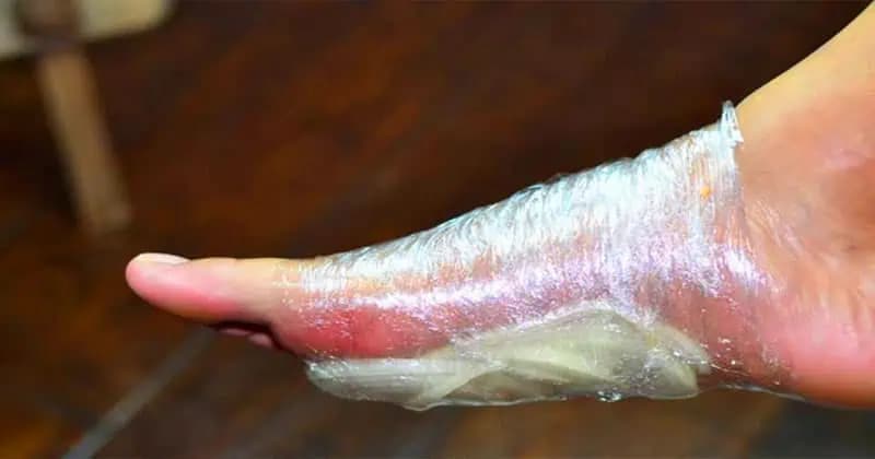 Vezmite len fóliu, obyčajnú CIBUĽU a zapamätajte si to na celý život: Starý trik, ktorý perfektne funguje aj dnes!