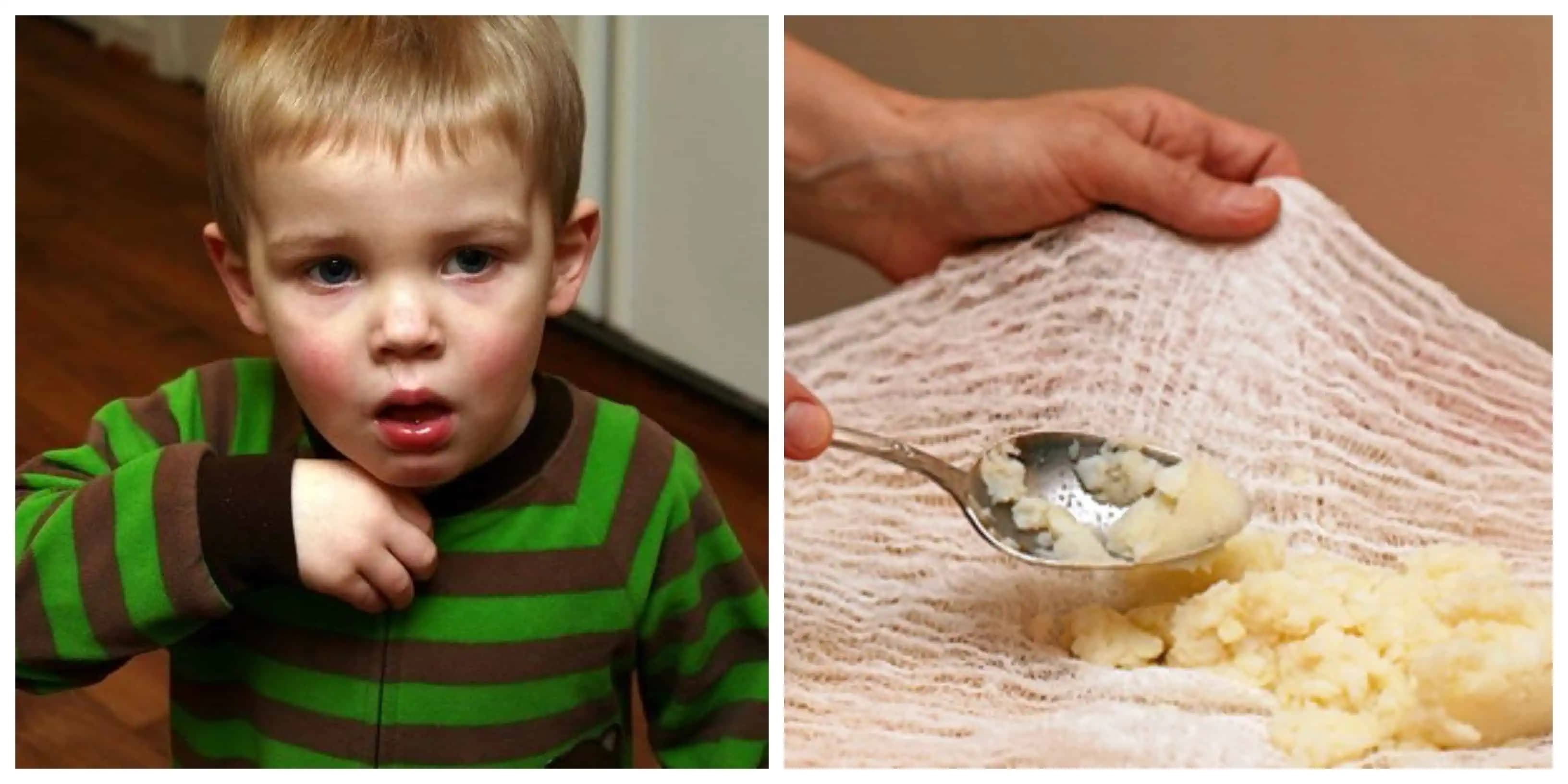 Keď KAŠEĽ páli a reže ako nôž, vždy pomôže tento OBKLAD: Záchrana na škaredý kašeľ, zápal a hlien v pľúcach!