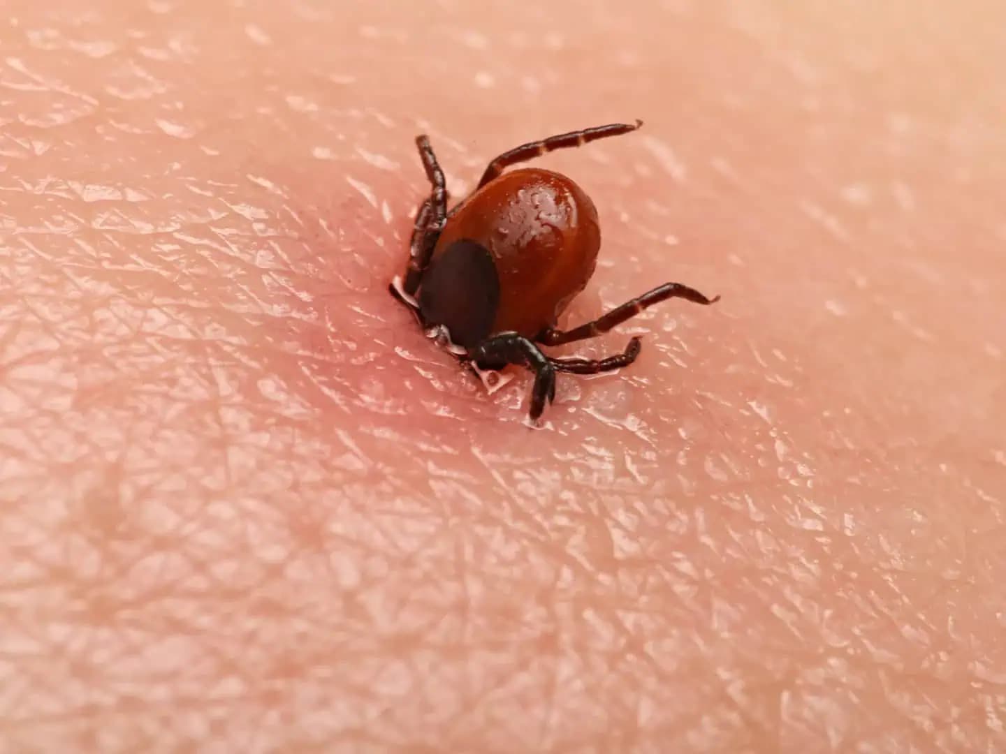 Lesník mi ukázal šikovný spôsob, ako si RAZ A NAVŽDY poradiť s kliešťami: Stojí to haliere!