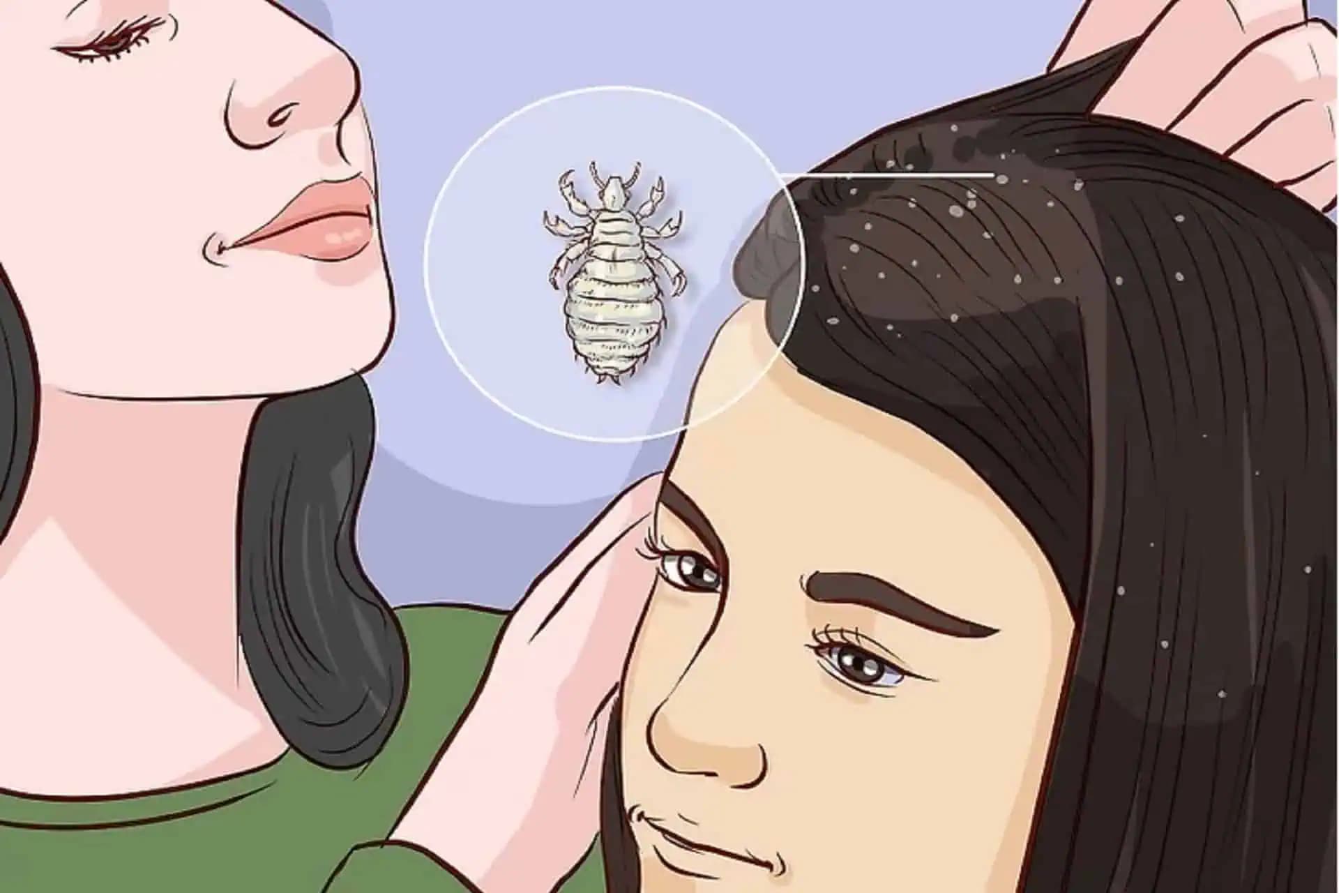 Na VŠI a HNIDY nekupujem chémiu, vďaka rade mojej babičky mám pokoj aj počas najväčšej epidémie: Najsilnejší likvidátor za pár centov!