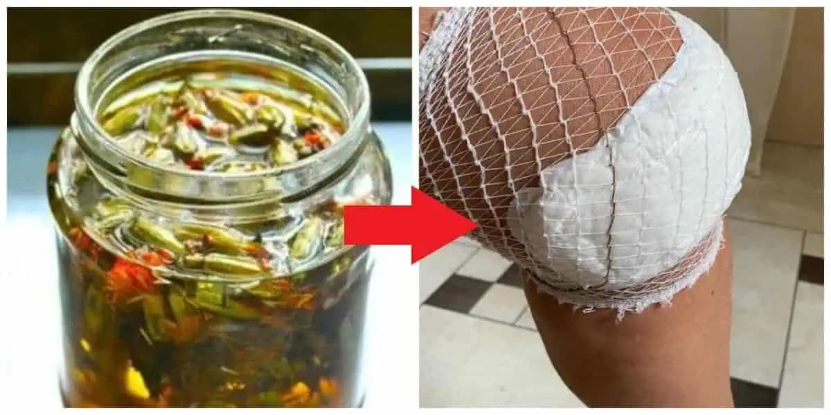 Dar z nebies na BOĽAVÉ KOLENÁ: Toto len priložte na koleno a nechajte pôsobiť, úľava hneď!