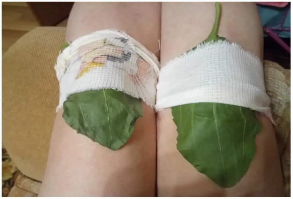 Toto radím každému, koho často bolia KOLENÁ: Musíte skúsiť, čo dokáže tento liečivý obklad!