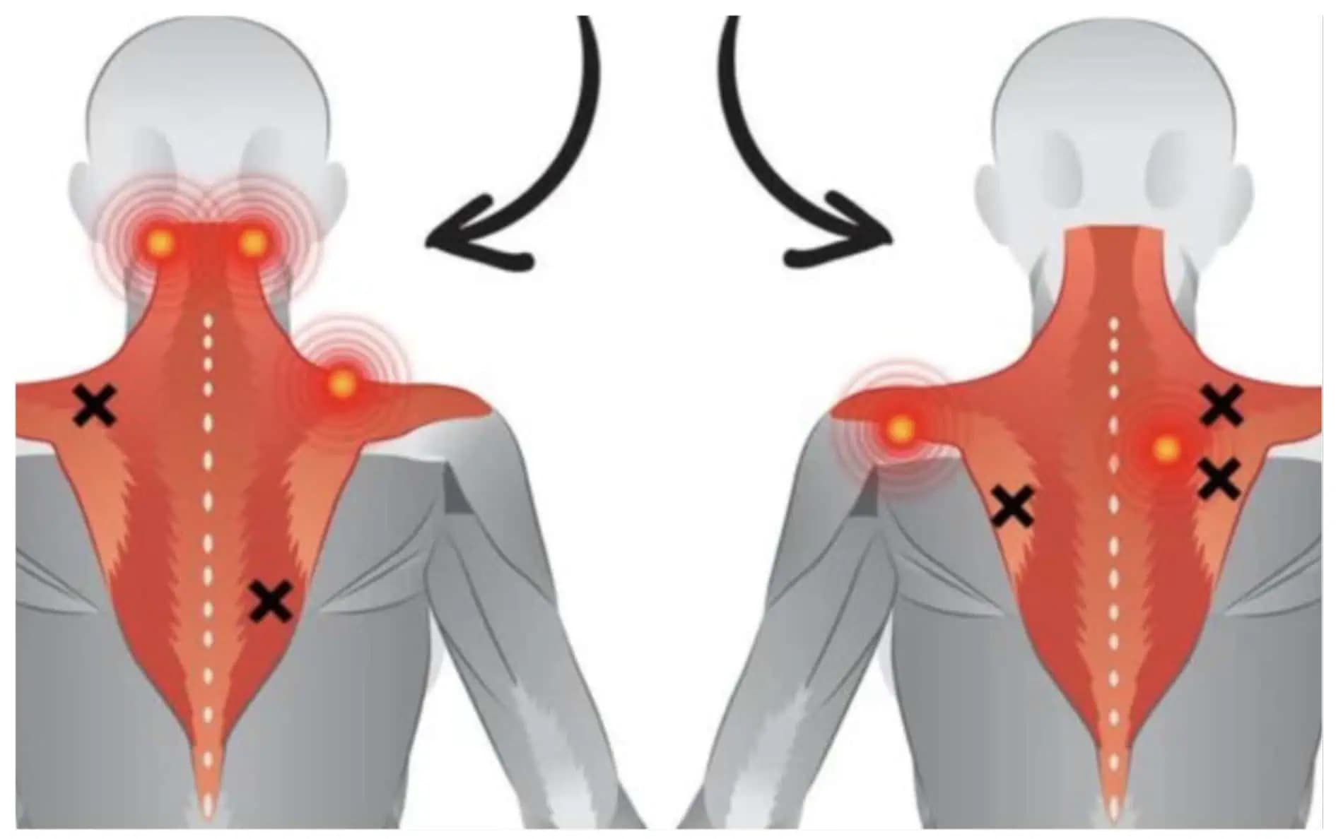 Nemecký ŠPECIALISTA na bolesť ukázal  jednoduchý cvik, ktorý dokáže uvoľniť napätie v krčnej chrbtici: Naučte sa ho!
