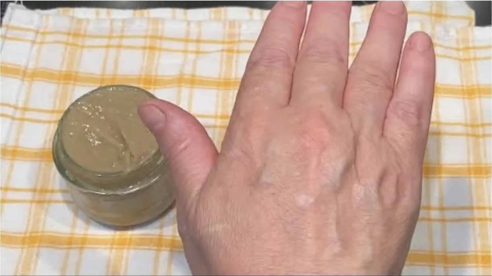 Omladí pokožku na rukách až o 10 rokov: Ruky sú jemné a bez vrások ako za mlada!