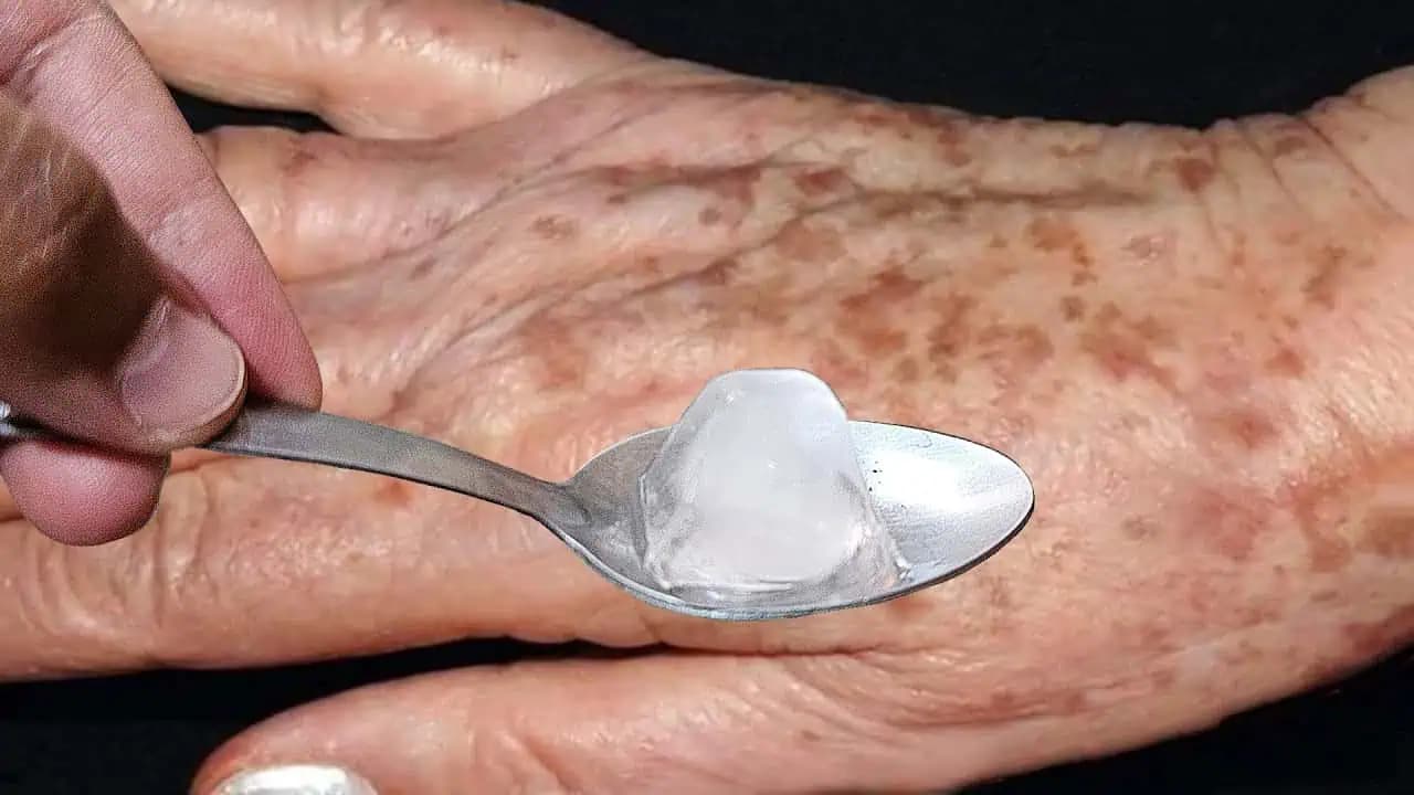 Moja babička to vedela už dávno: Stačí votrieť kukuričný škrob na tmavé škvrny a všetky zmiznú!