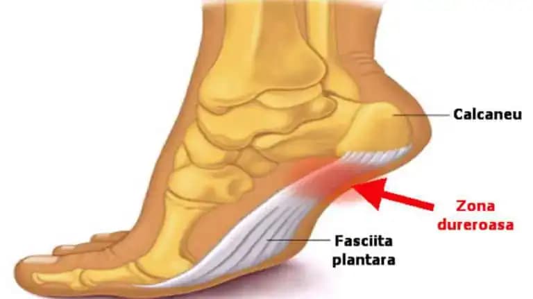 Väčšinu ľudí po 40-tke trápi bolesť chodidiel: Fyzioterapeut ukázal jednoduché pohyby, ktoré zlikvidujú bolesť a opravia aj ploché nohy!