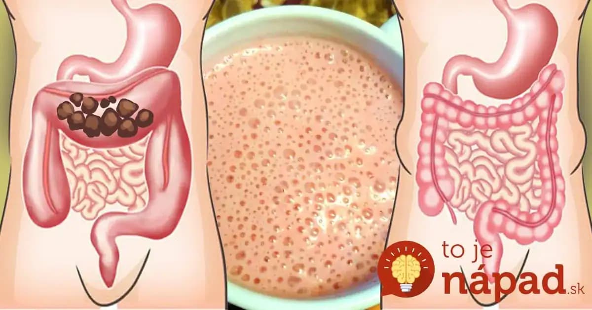 Stačí týždeň a trávenie ako za mlada: Najsilnejšia zmes na čistenie čriev – zbohom toxíny, unavená pleť aj bolesť brucha!