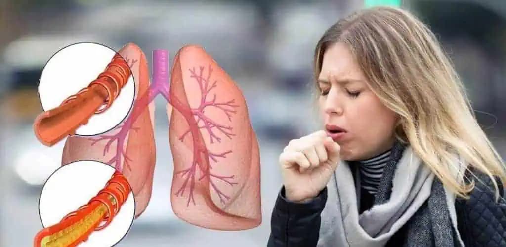 Zaručený domáci trik, ako zmierniť kašeľ a odstrániť hlien z hrudníka a hrdla: Všetky príznaky zmizli za 72 hodín!