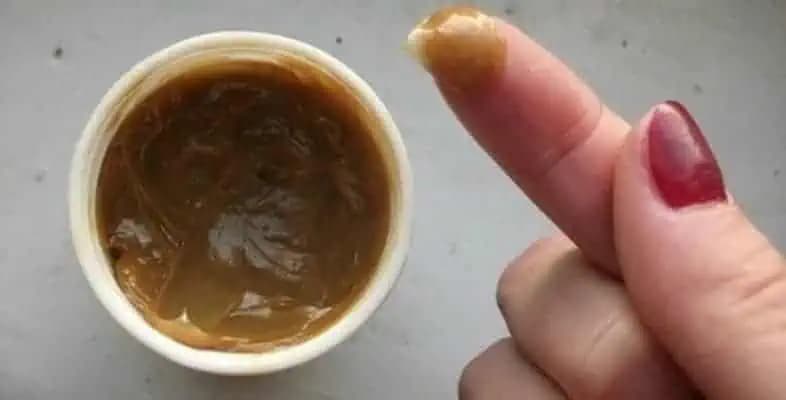 Moja mama pozná domácu masť, ktorá rýchlo tíši bolesti kĺbov, zmierni opuch kolien aj nekonečné bolesti chrbta: TU je recept!