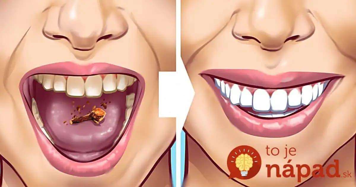 Zbohom drahé bieliace pasty, máte to celý čas pod nosom: Toto likviduje škvrny na zuboch a povlak na počkanie!