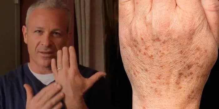 Cibuľová šťava + jablčný ocot: Len ZAMIEŠAJTE a raz a navždy sa zbavte pigmetnovýc škvŕn na rukách, tvári, dekolte!