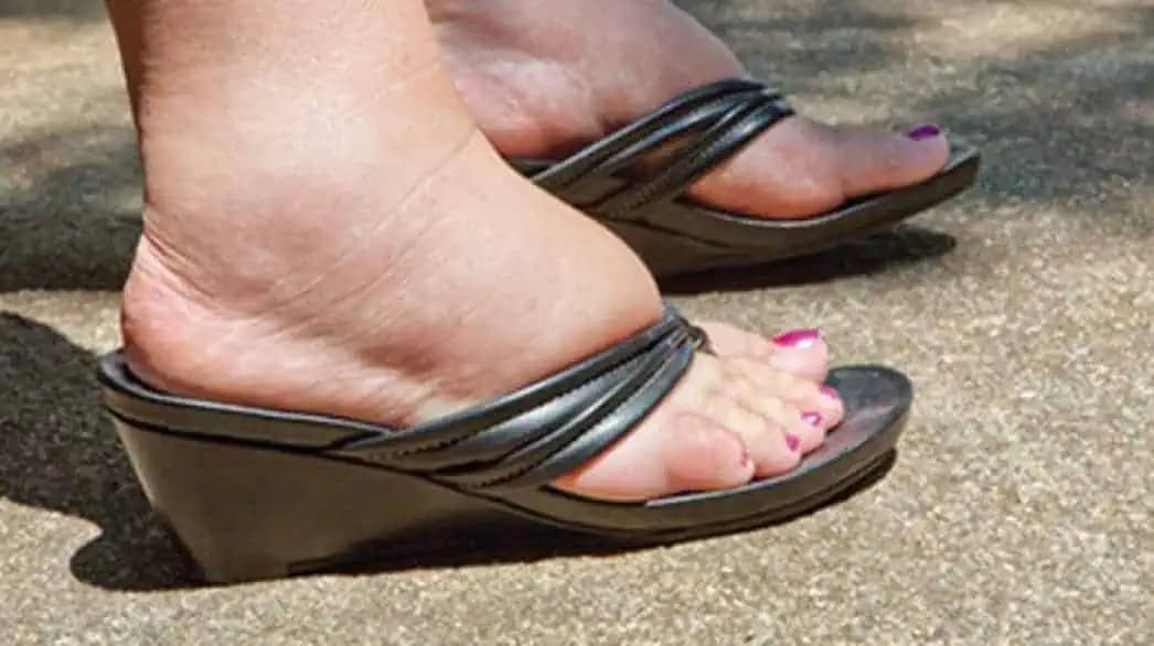 Po 50-tke ma začali trápiť opuchy nôh a kŕčové žily: Vyskúšala som BABIČKINU radu a odvtedy neviem, čo sú tieto problémy!