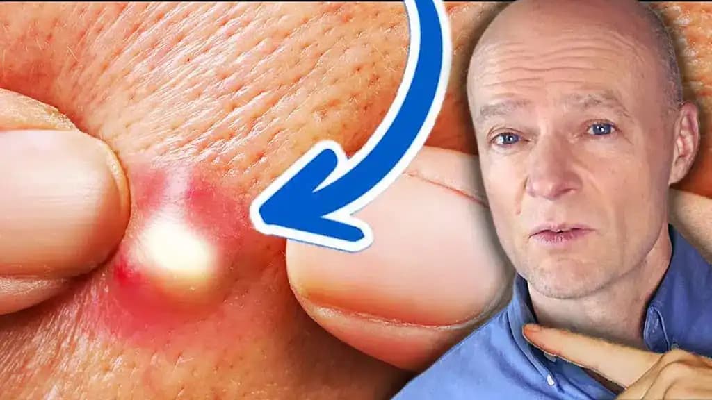 Lekár varuje: Toto je 10 JASNÝCH signálov, že jete príliš veľa cukru. Málokto si ich všimne!