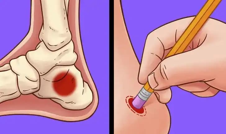 Terapeut ukázal zázračný spôsob, ako pomôcť boľavým nohám: Nikdy by sme neverili, že stačí zatlačiť na toto miesto!