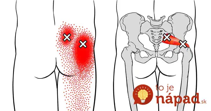 1 minúta dokáže odblokovať zacviknutý nerv: Každý, koho bolí každý pohyb by sa mal naučiť toto – funguje hneď!