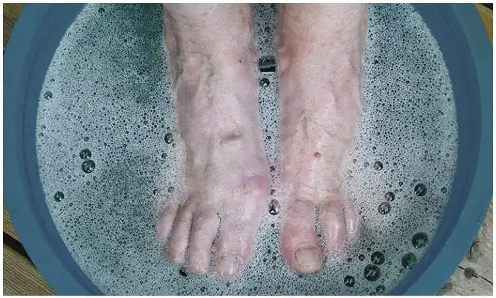 Raz za týždeň si namočte nohy do tohoto KÚPEĽA a sledujte, ako BOLESŤ a choroby začnú rýchlo miznúť!