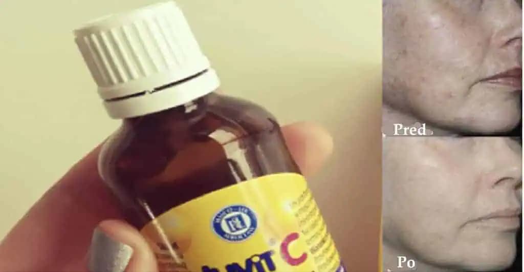 V lekárni to kúpite za drobné, ale ušetrí vám STOKRÁT viac: Lacný zázrak odstraňuje vrásky, strie a škvrny na koži!