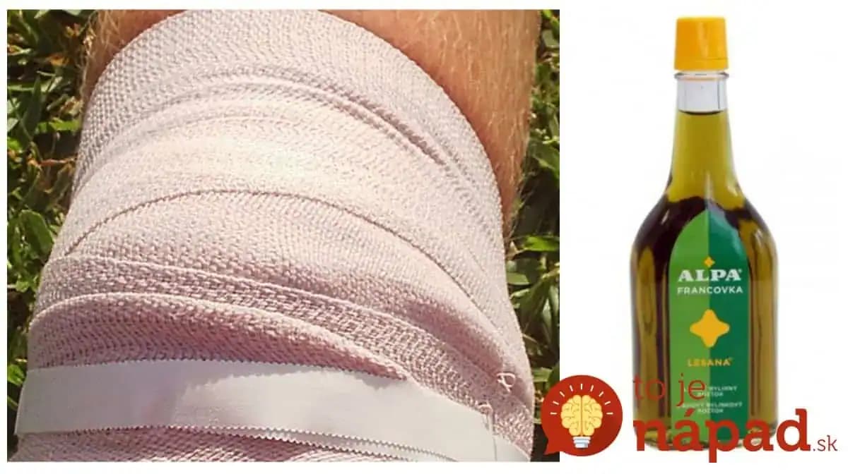 Odskúšané, funguje rýchlo: Liečivý obklad pri zápaloch kĺbov, na boľavé kolená aj na karpálny tunel!