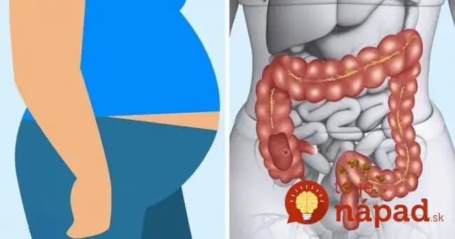 Po 50-tke dajú do poriadku to, čo ste celé roky kazili: 10 potravín, ktoré vyplavia kilogramy, zlikvidujú choroby a pomôžu kĺbom!