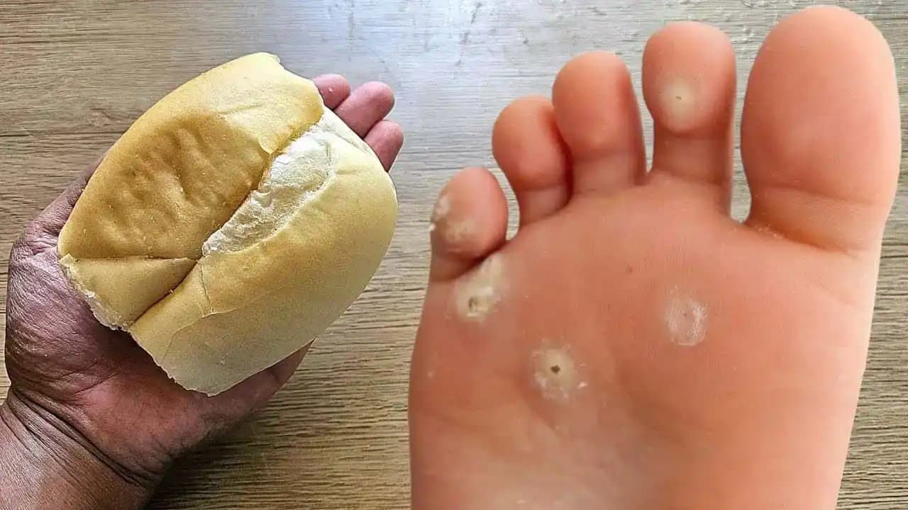 EXTRÉMNE účinný trik, ako sa zbaviť kalusov a zhrubnutej kože na nohách: Potrebujete len starší chlieb!