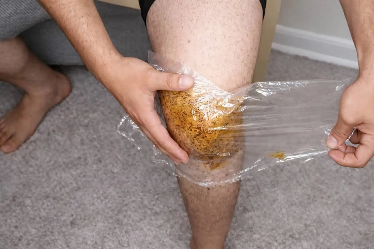 Uľavilo sa mi prvom použití: Vďaka tomuto domácemu krému odišla bolesť kolien, chrbtice a kĺbov!