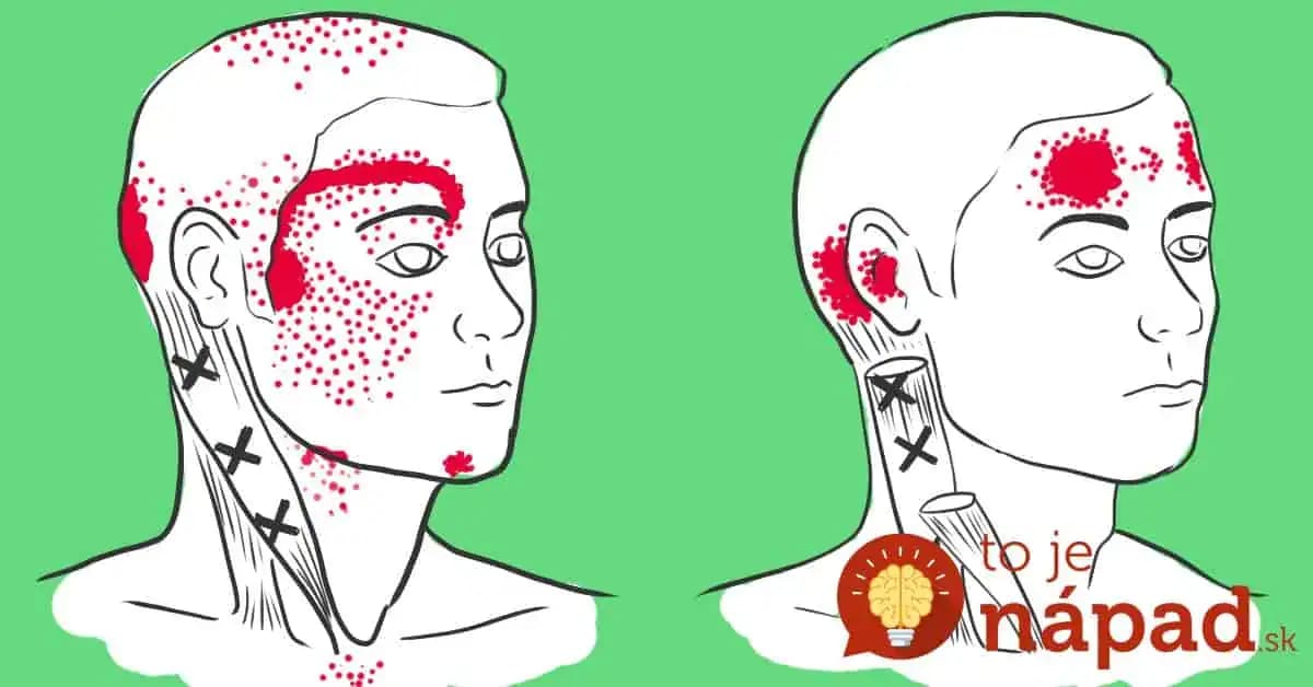 Nedostatok týchto potravín spôsobuje bolesť hlavy, stratu vlasov a ďalšie problémy: Škoda, sme to nevedeli skôr!