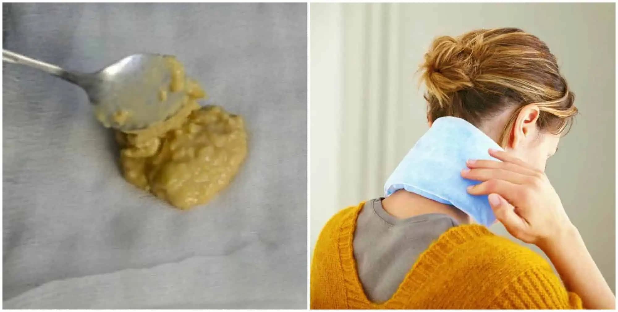 Tvaroh zmierni opuch, zemiak vytiahne zápal a med likviduje bolesť: 8 domácich obkladov na kĺby a chrbticu!