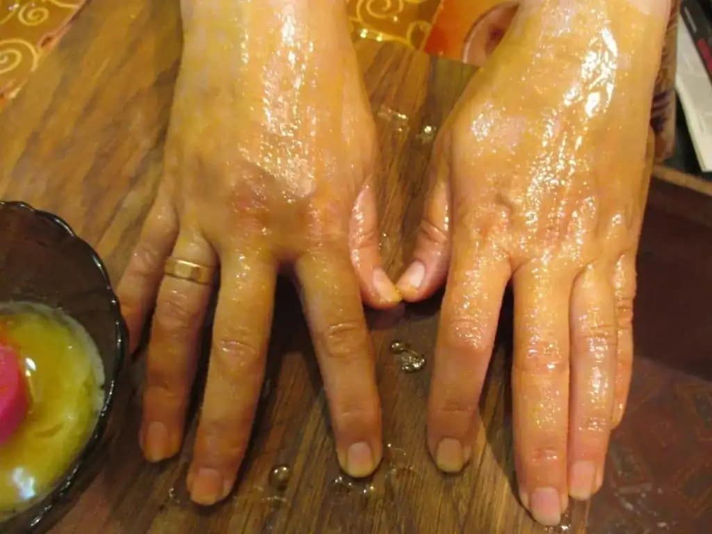 Kozmetička to radí každému, koho trápia pigmentové škvrny na rukách: S týmto zázrakom miznú za 24 hodín a pokožka skrásnie!