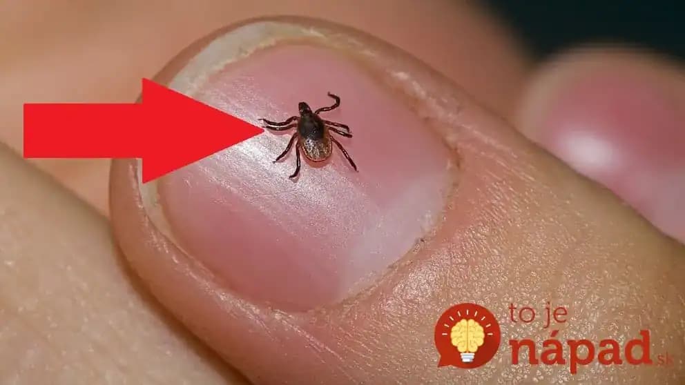 Bič na nenávidené kliešte: Stačí urobiť toto a vyhnú sa vám aj vášmu psíkovi + rada ako ich dostať z dvora!