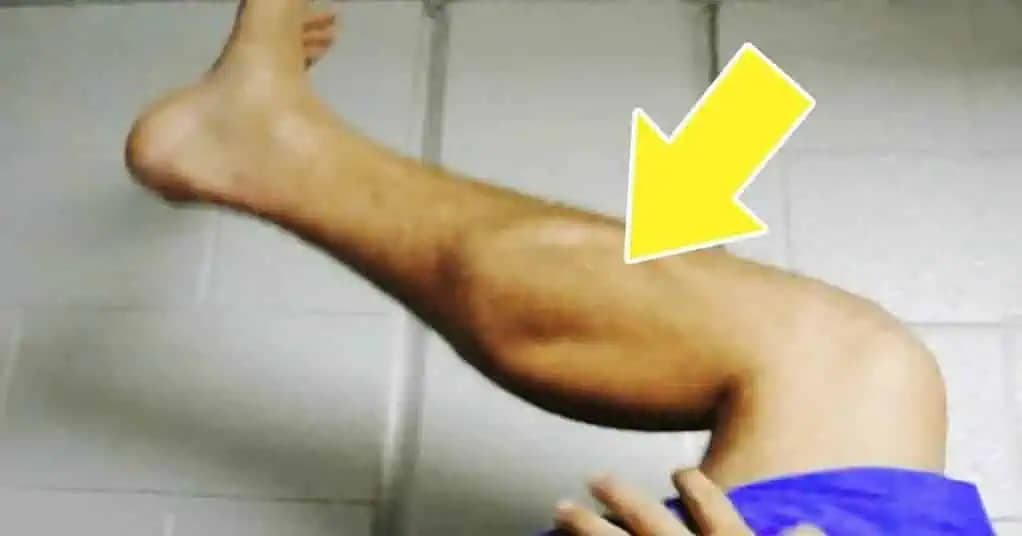 Toto by mal vedieť každý, koho trápi bolesť a zvlášť KŔČE v nohách: Musíte skúsiť, čo dokáže tento domáci RECEPT!