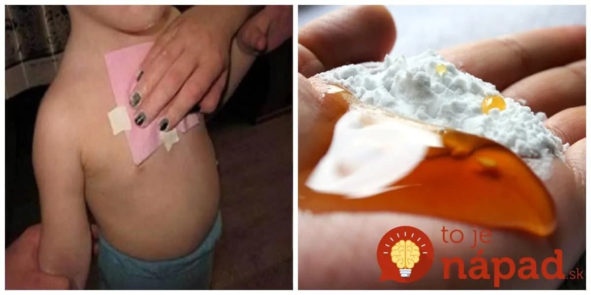 Toto povedzte každému, koho trápi kašeľ a boľavé hrdlo: Overené, odskúšané – toto zaberie za 1 noc!