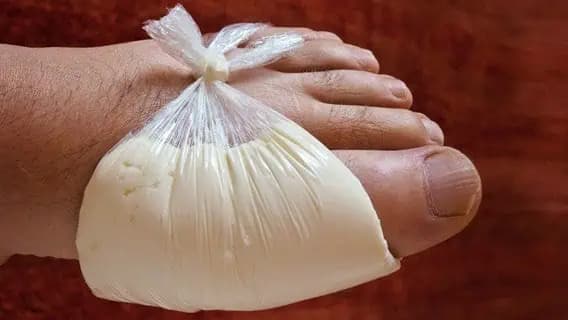 Starý trik športovcov, ktorý zaberá na zápal, bolesť aj opuch kĺbov najrýchlejšie: Odskúšané, funguje!