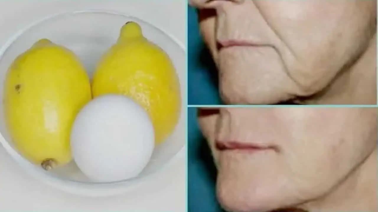 Suseda kozmetička mi dala recept na domáci BOTOX, ktorý vygumuje vrásky: Mínus 10 rokov a rozjasnená pleť!