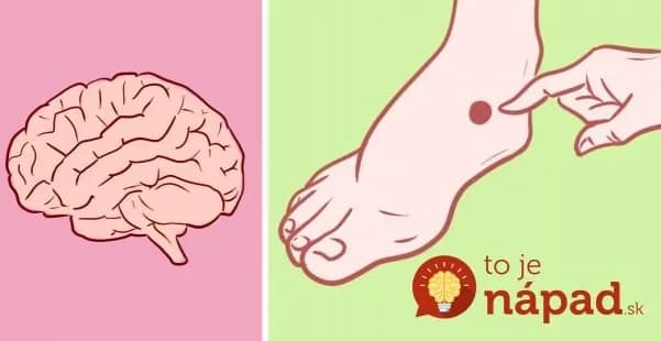 Prvé príznaky cievnej mozgovej príhody. Ak ich na sebe spozorujete, musíte rýchlo konať!