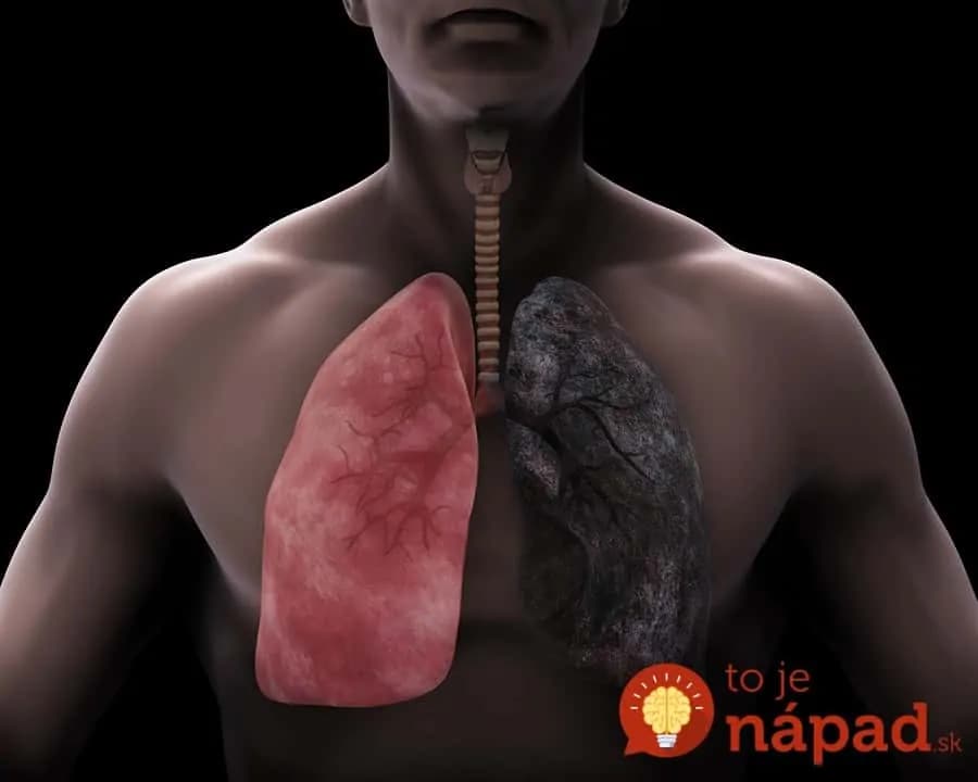 Výborná očista pre pľúca, ktorá by mala byť povinná pre každého, kto fajčil: Pľúca ako nové a rozlúčite sa aj s únavou!