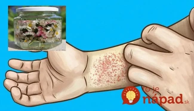 Keď skúsite, čo tento kvietok dokáže s boľavými nohami a pokožkou, budete si ho všímať oveľa viac: Takto z neho vyťažíte maximum!