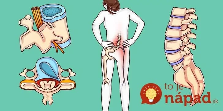 Chirurg poradil 5 cvikov, ktoré dokážu zachrániť chrbticu aj v 60-tke: Pár minút spevní hlboké svaly, ktoré sú pre zdravý chrbát najdôležitejšie!