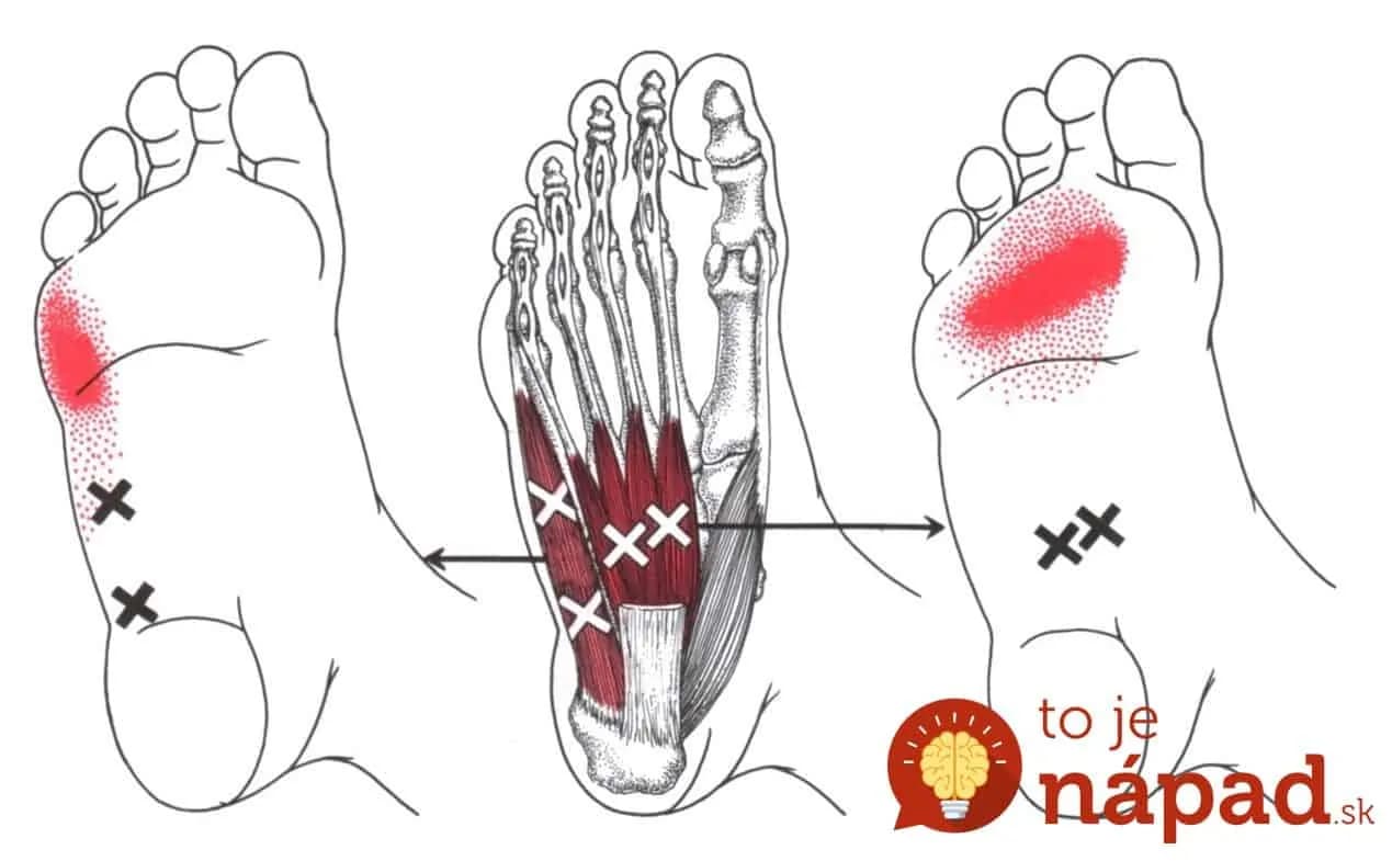 Lekár ukázal najjednoduchší spôsob ako natrvalo pomôcť chrbtci cez vaše nohy: Odstráni to kŕče, bolesť a únavu!