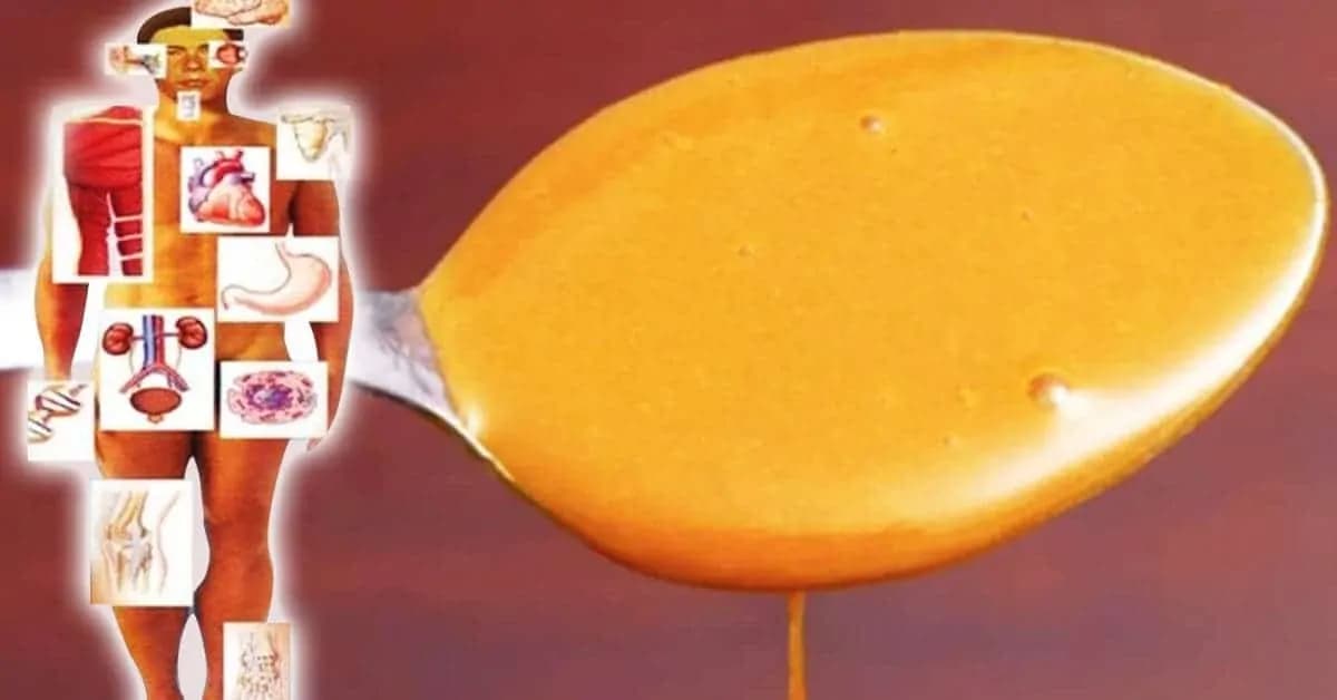 Med, citrón a kurkuma: Najsilnejšia zmes na prevenciu chorôb a posilnenie imunity!