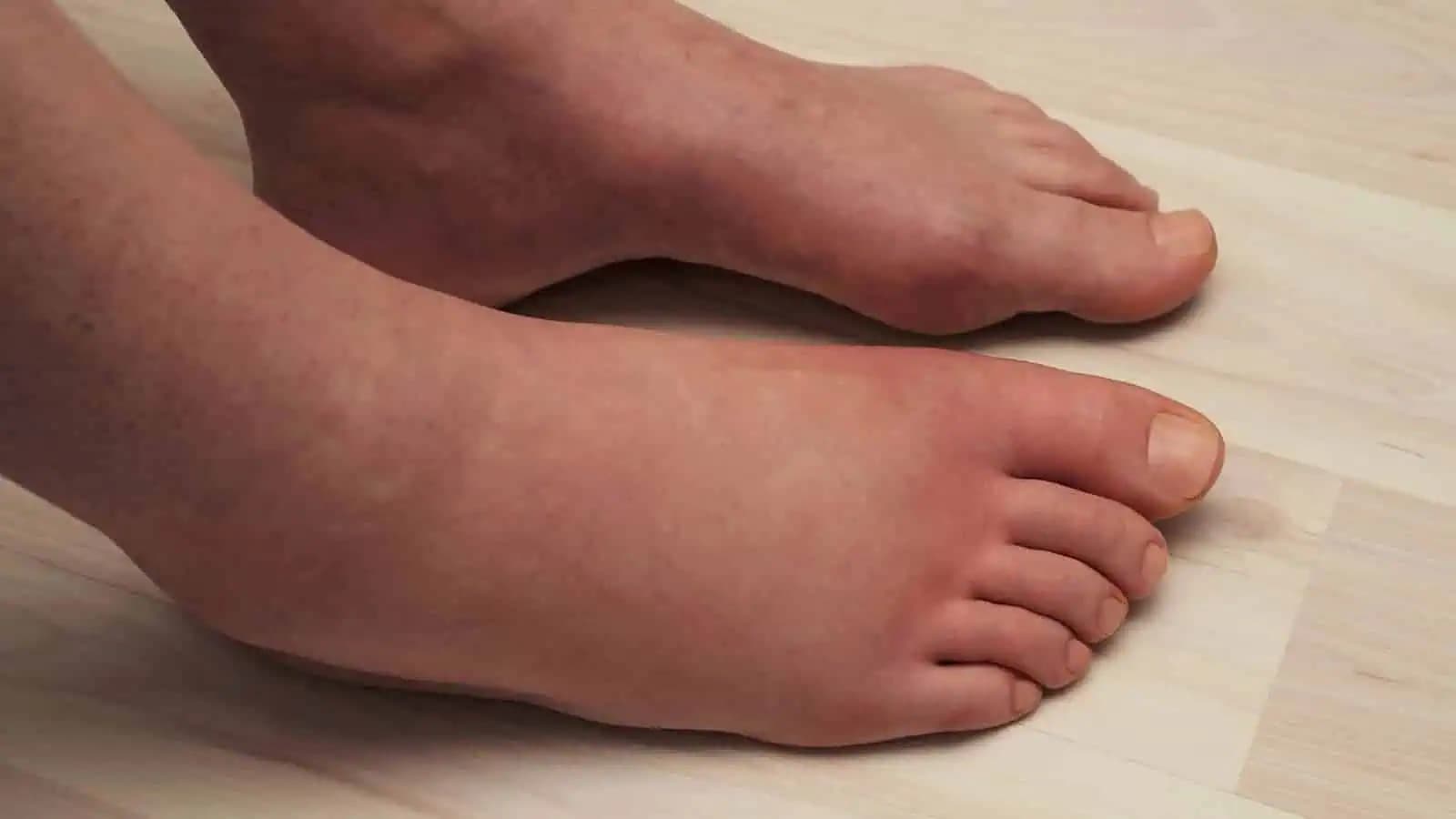 Toto doslova vytiahne zadržiavanú vodu z vášho tela a KILÁ idú dole: 10 potravín, ktoré dajú po 50-tke do poriadku postavu aj zdravie!