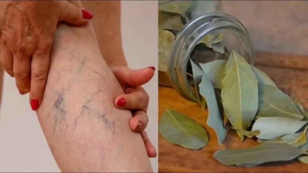 Prírodný RECEPT na bolesti nôh, kŕčové žily a opuch: Dajte bobkový list do horúcej vody!