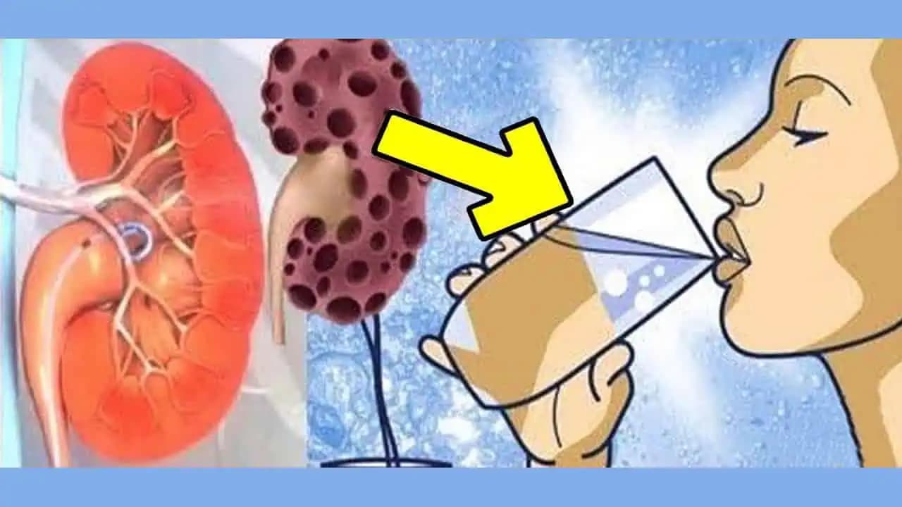 Týchto 8 vecí NIČÍ vaše obličky. Stavím sa, že číslo 7 robíte aj vy!