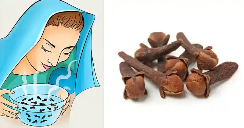 Každý by mal vedieť, akú silu má vdychovanie pary z klinčekov: Pomôže to hneď!