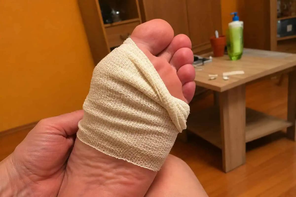 Zaručený domáci TRIK, s ktorým som sa zbavila bradavice za 4 dni: Poradila mi to starká, používam to už roky!